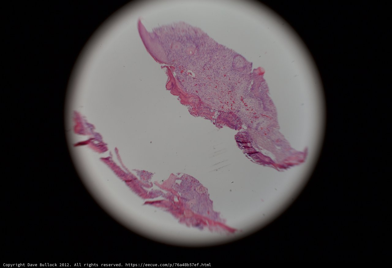 Stained Tissue Micrograph