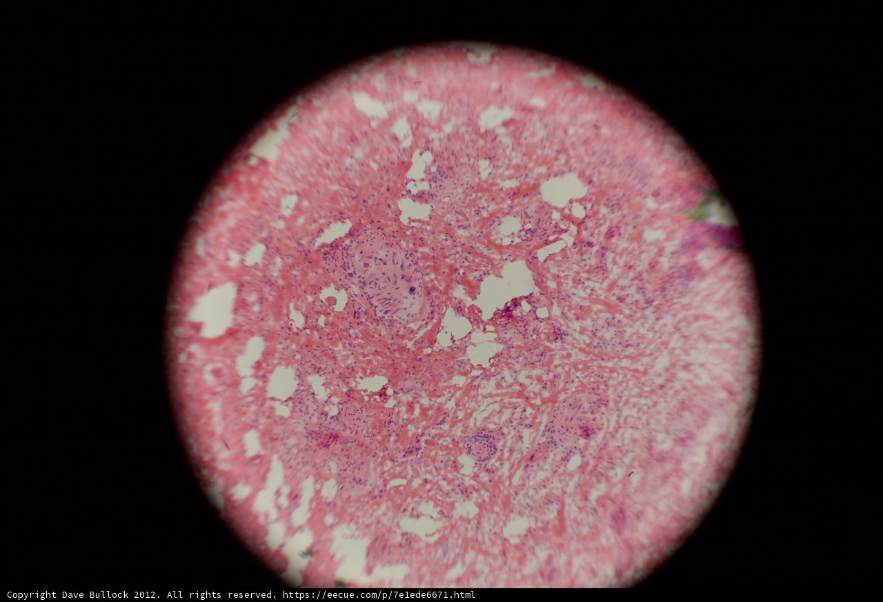 Pink Spot in a Sea of Black