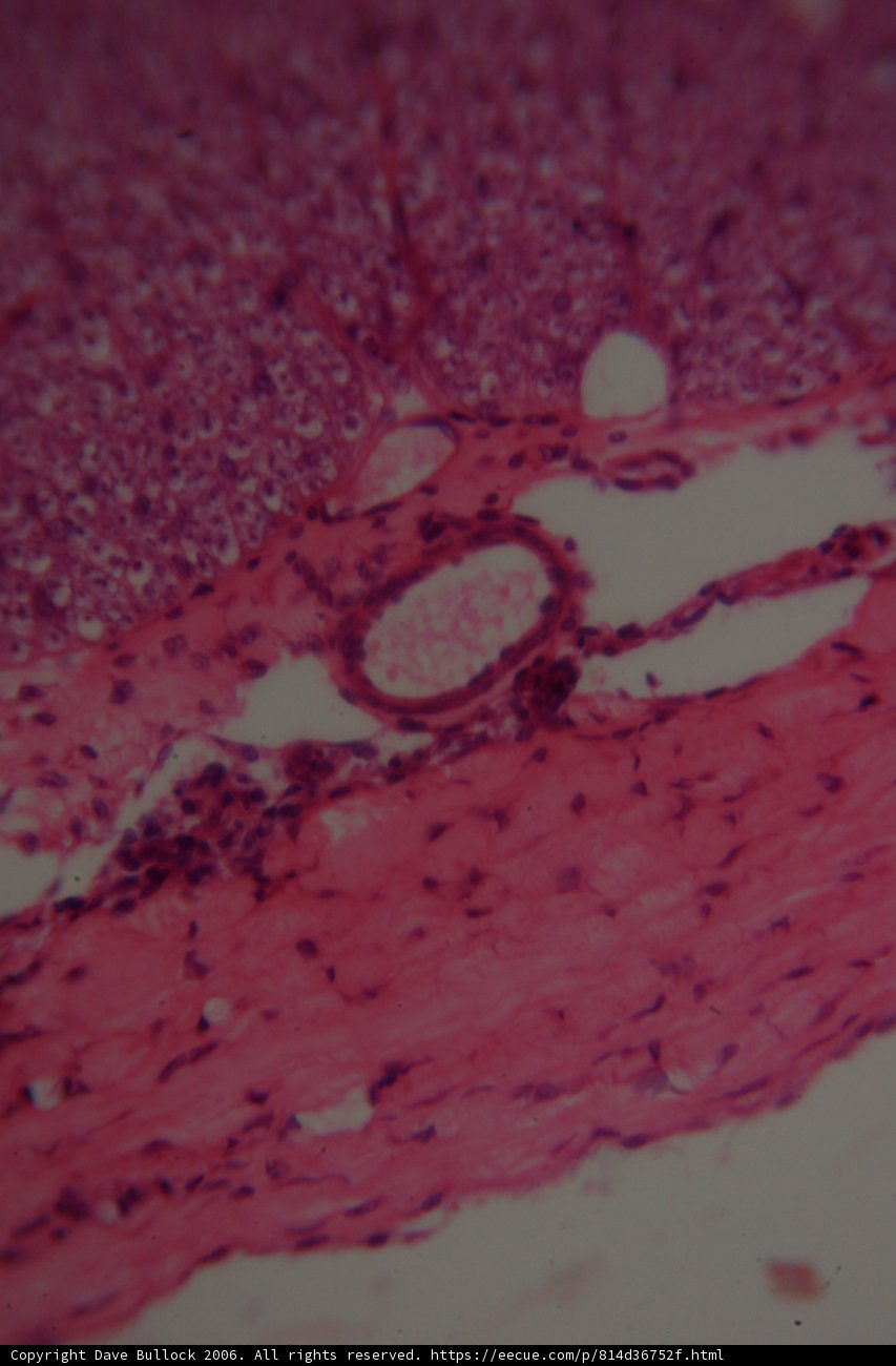 A Purple Stained Tissue