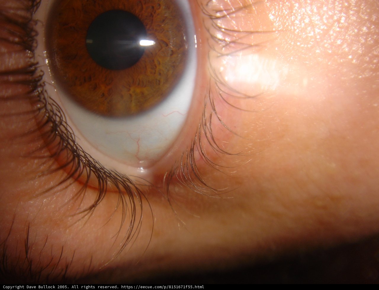 Brown-Eyed Stare