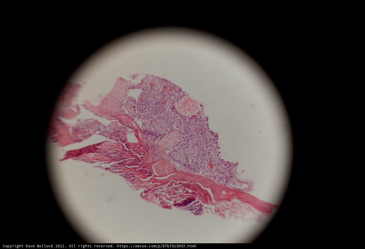 Stained Tissue in Close-up