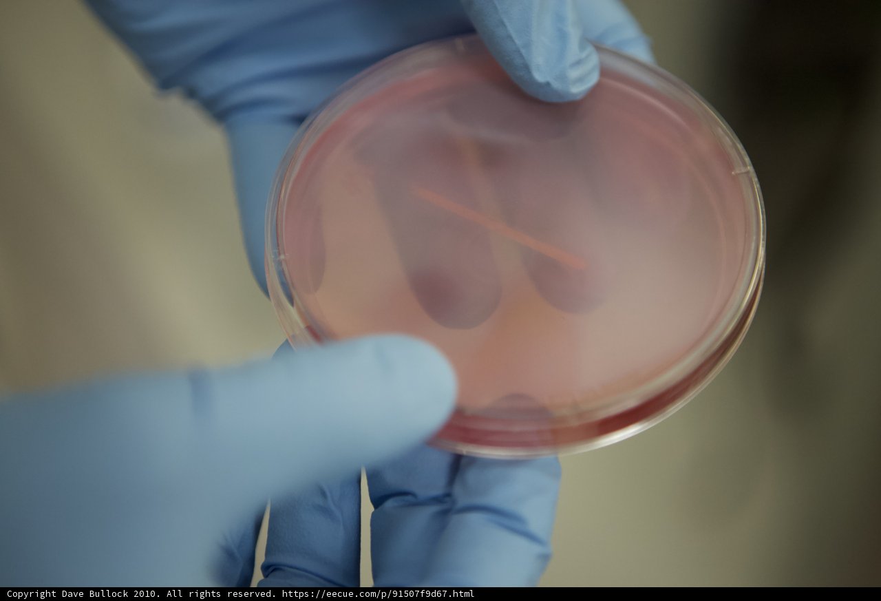 Gloved Hand Holds Petri Dish