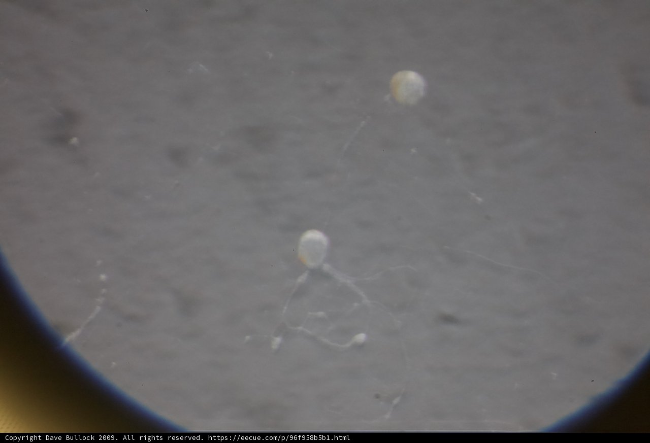Jellyfish Under the Lens