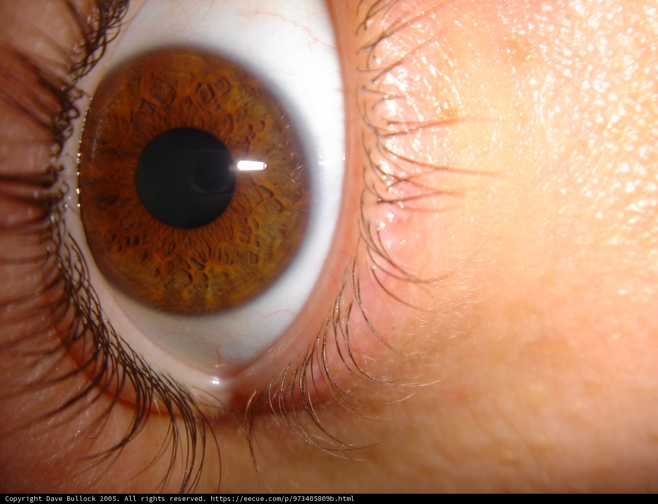 Intense Brown Eye
