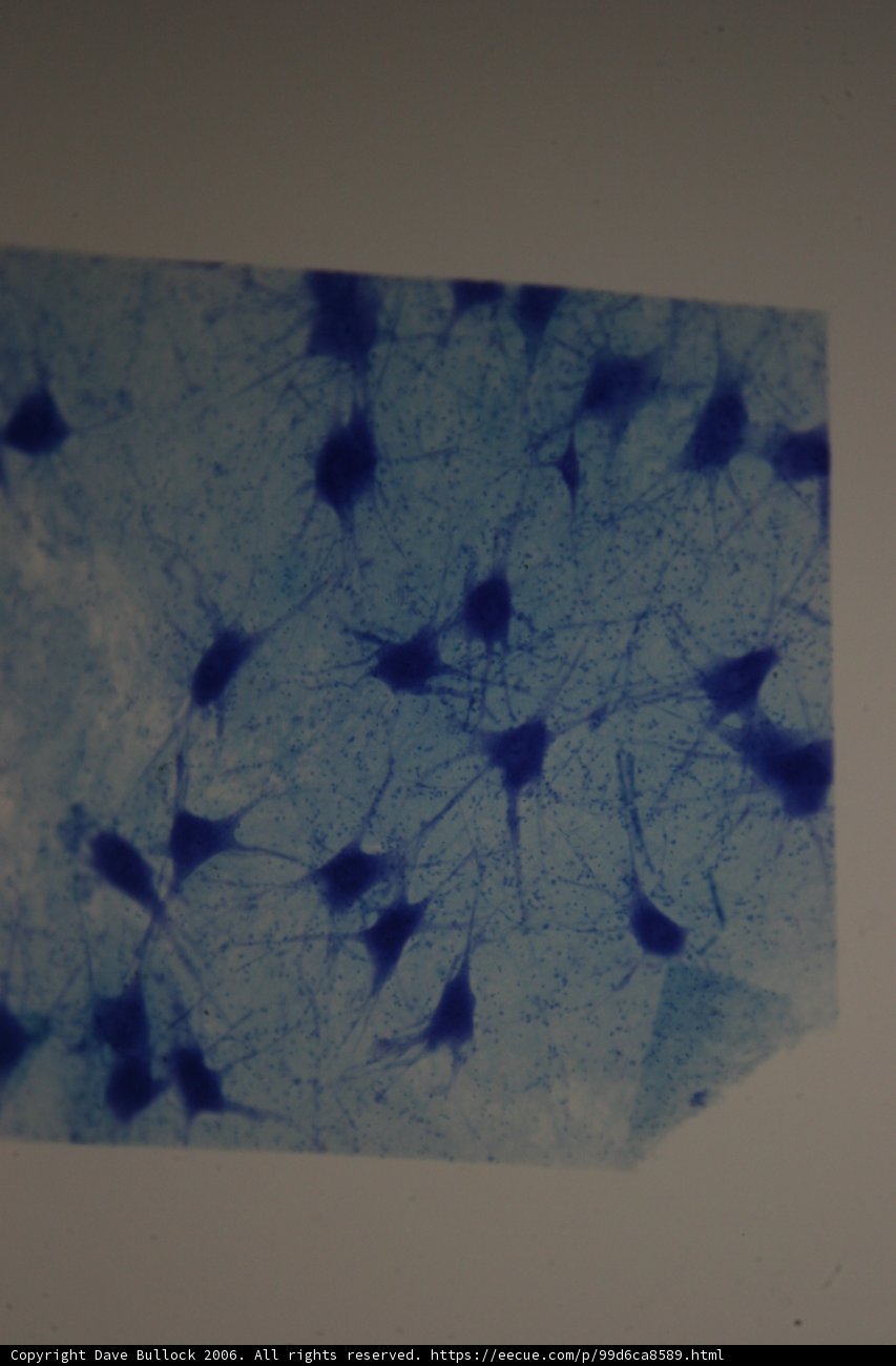 Blue Cell with Miniature Cells