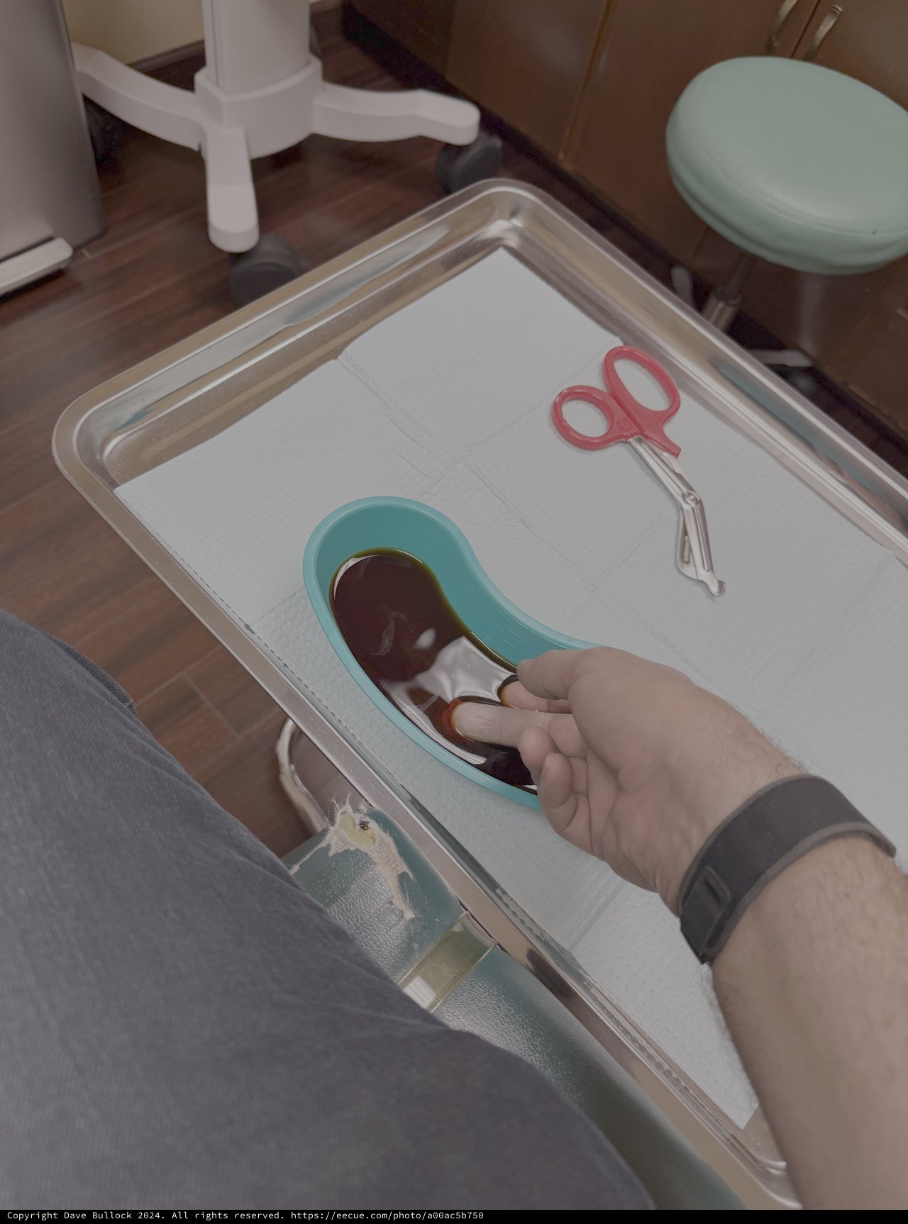 Medical Hand Examination in Clinical Setting
