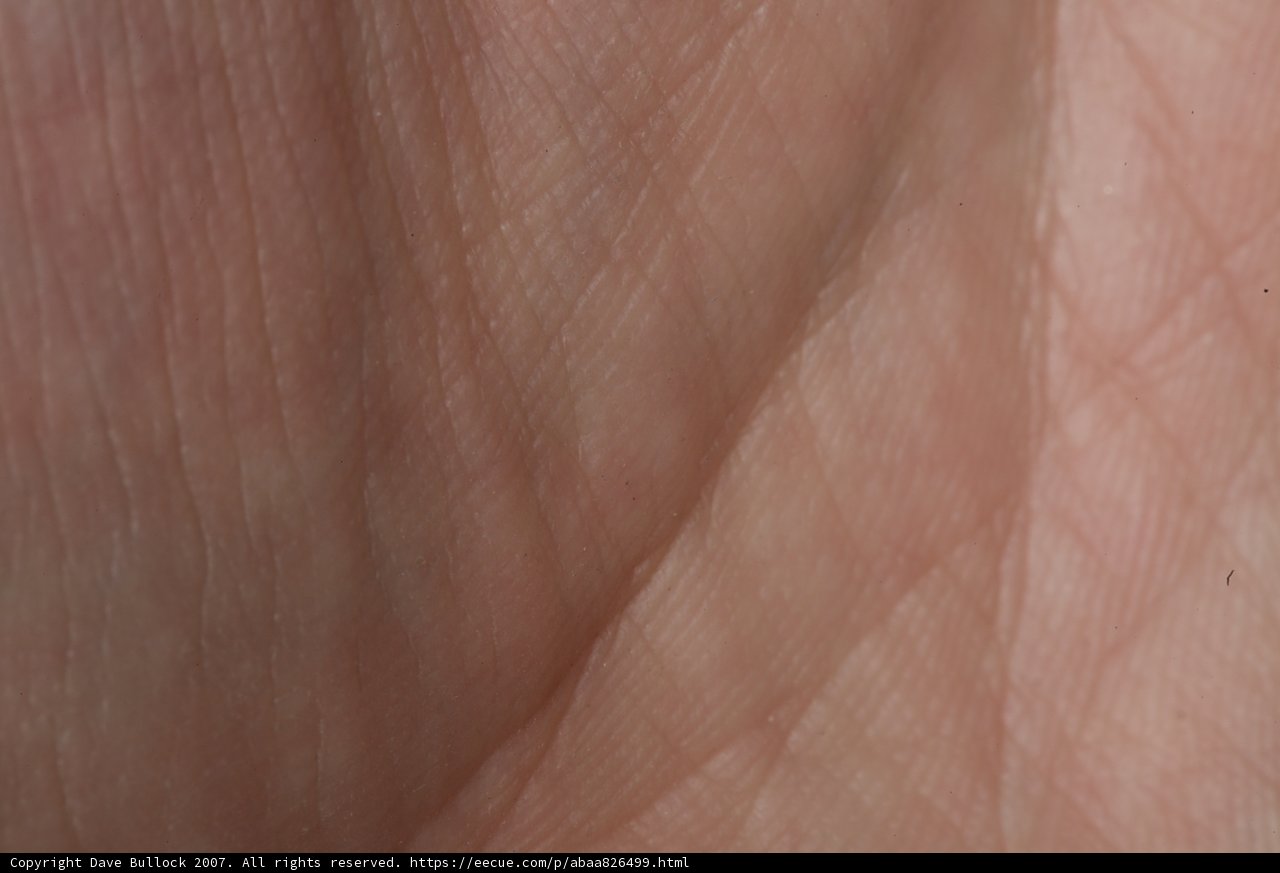 Skin Texture Close-Up