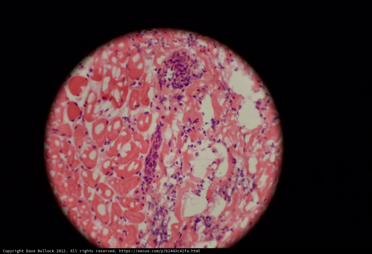 Pink and White Egg Stain
