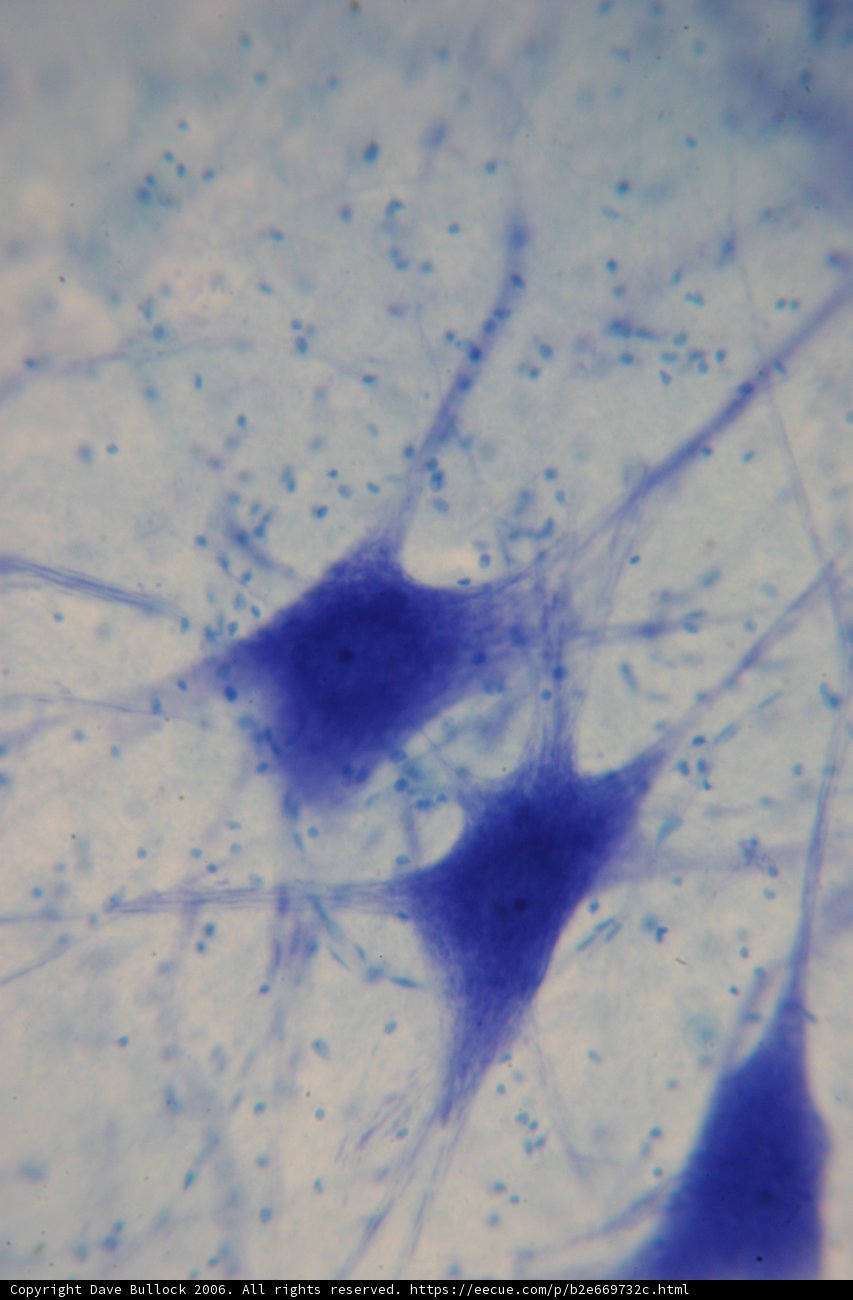 Blue Spots in the Cell