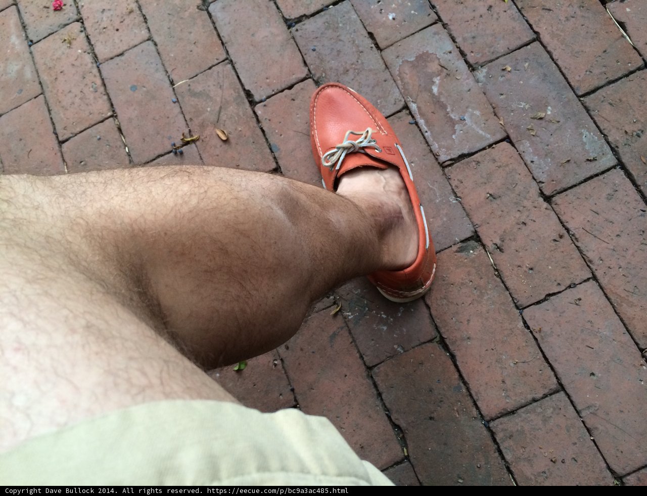 Orange Sandals on a Brick Path