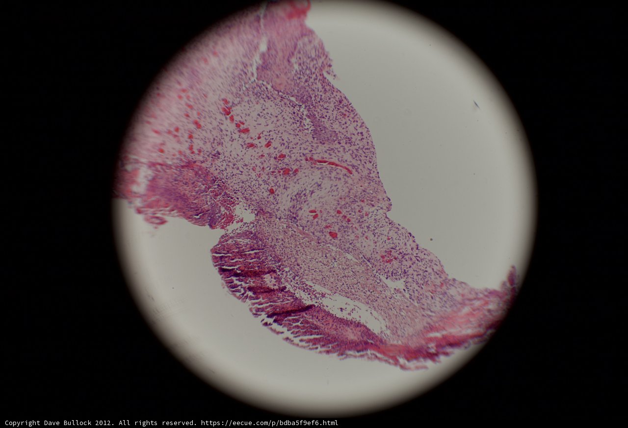 Vivid Tissue Colors