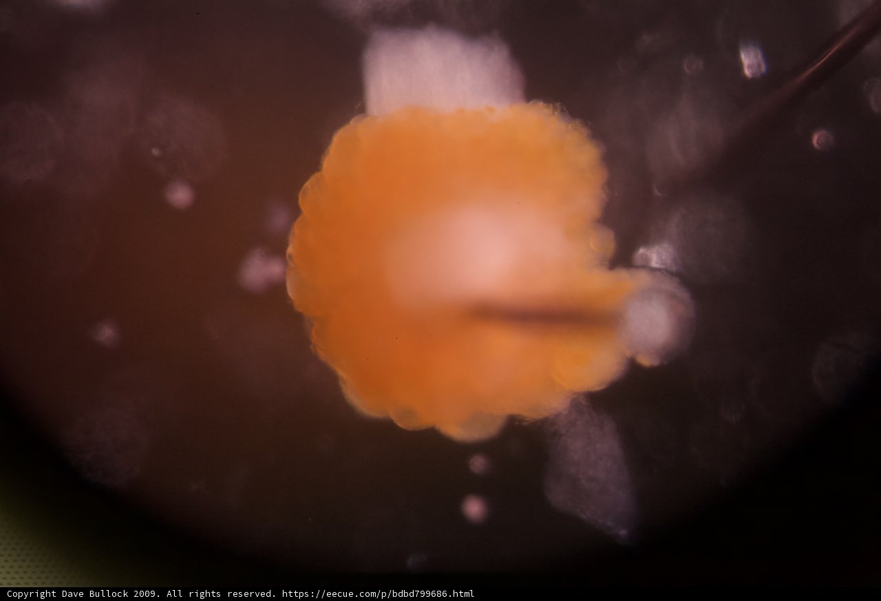 Microscopic View of a Jellyfish