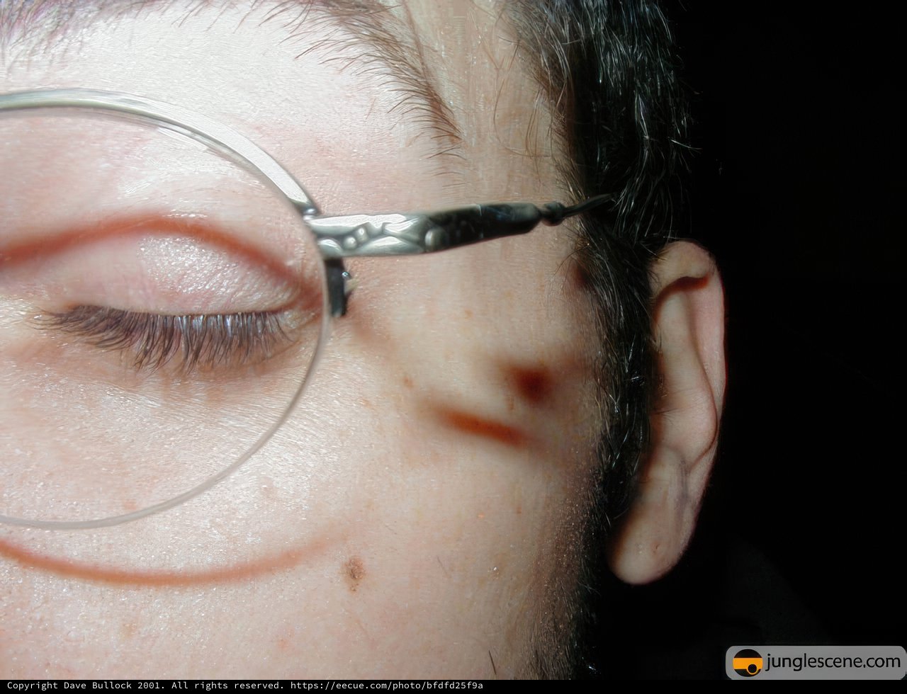 Bruised but Bold