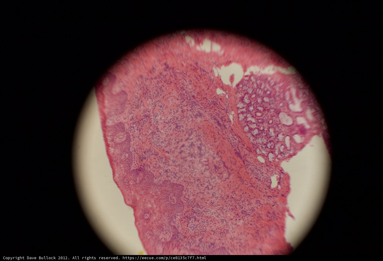 Stained Tissue Sample