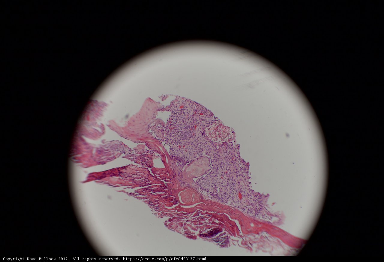 Pink and White Tissue Up Close