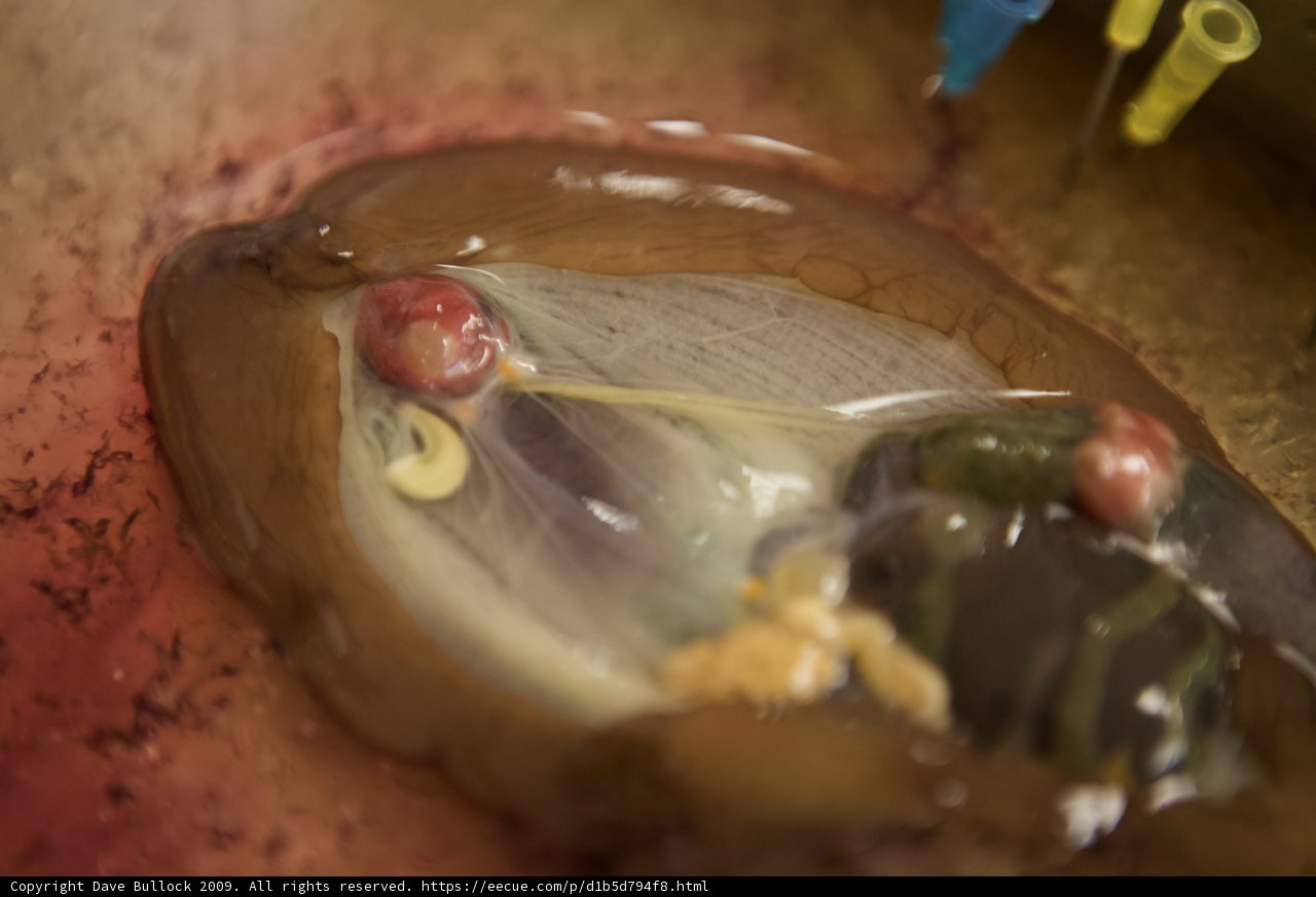 Intriguing Aquatic Object Found in Human Body