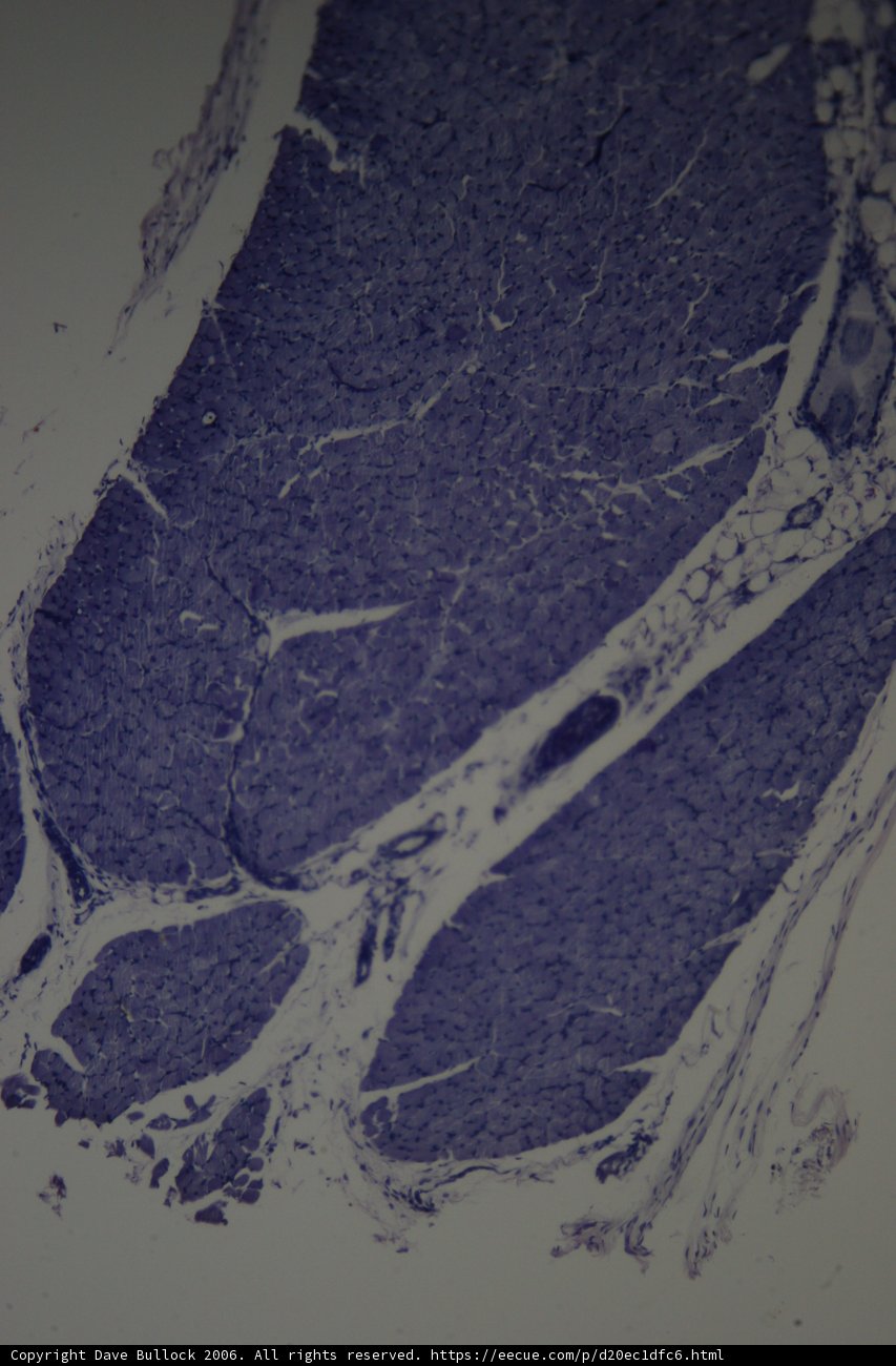 Artistic Stain on Tissue