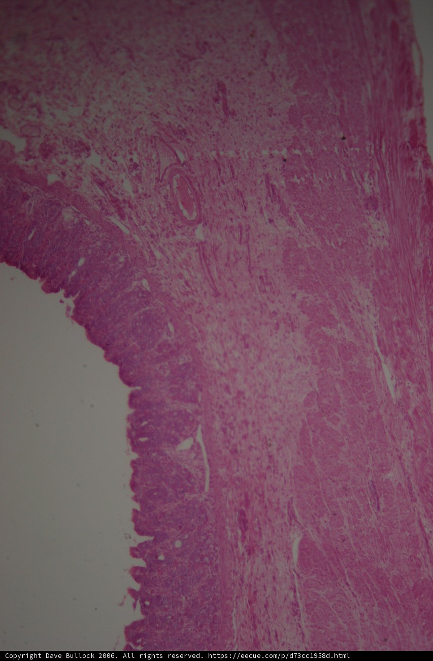 Pink Tissue with White Line