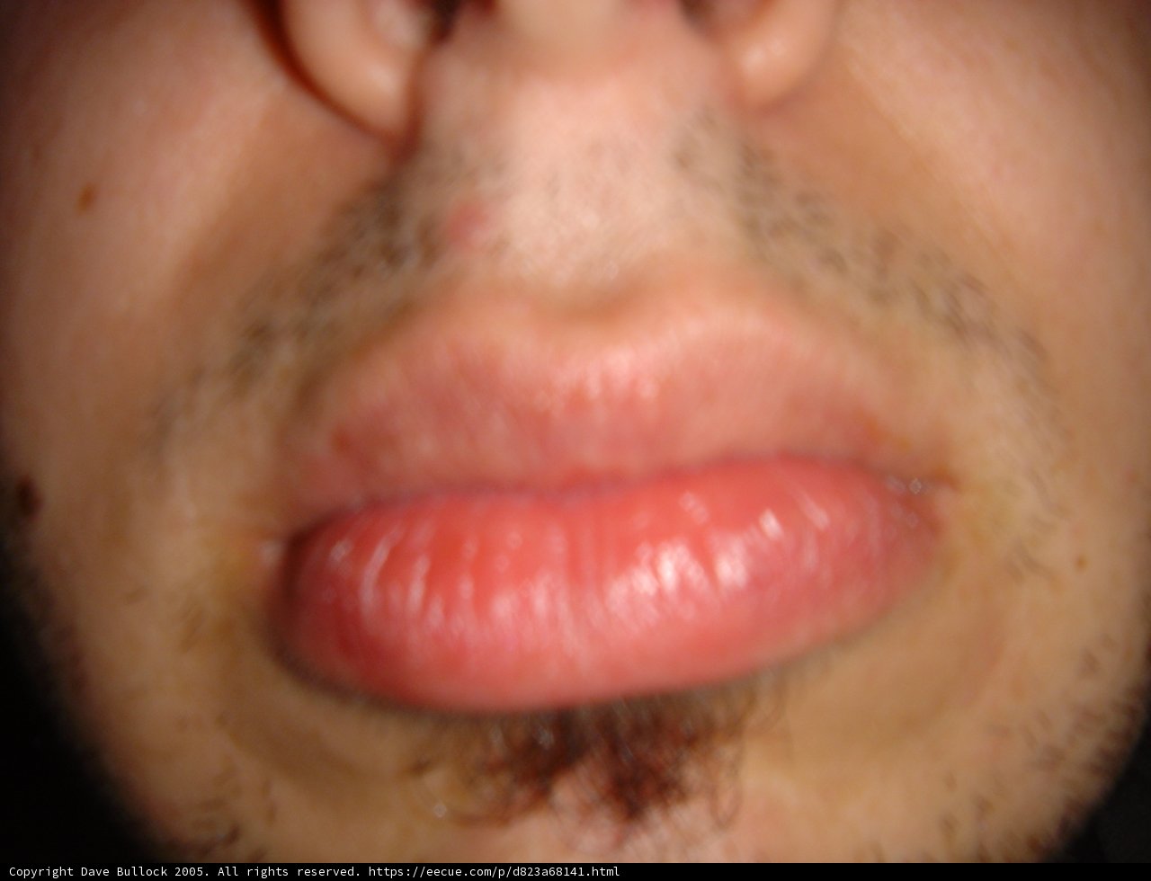 The Red Tongue