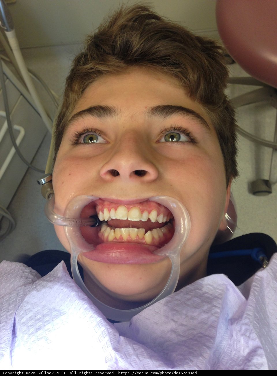 Flashing a Grin: The Pre-Dentist Adventure