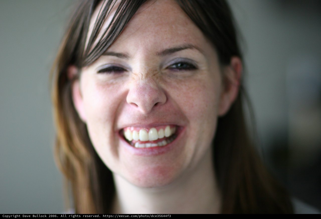 Joyful Woman with Freckles Laughing Candidly