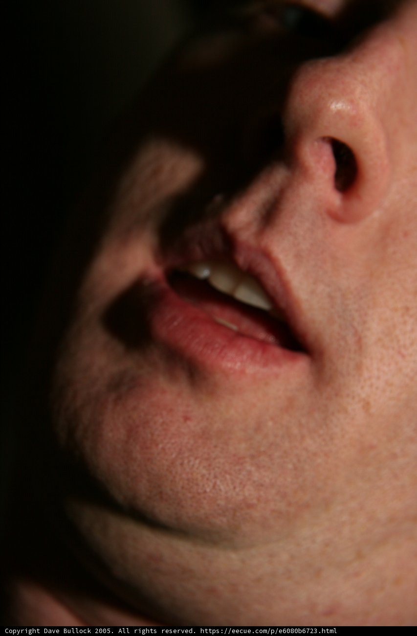 Open Wide