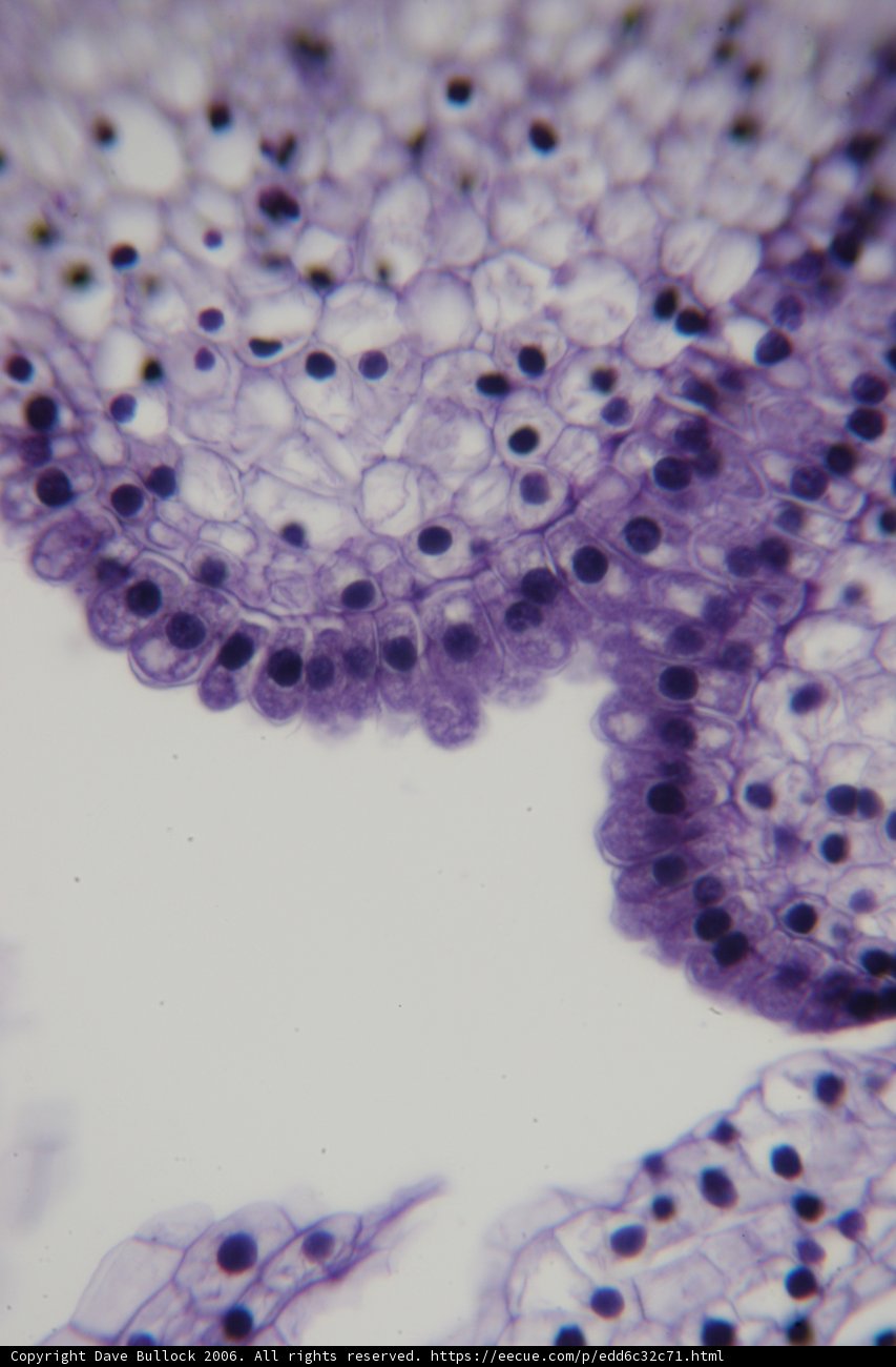 Cell with Many Small Dots