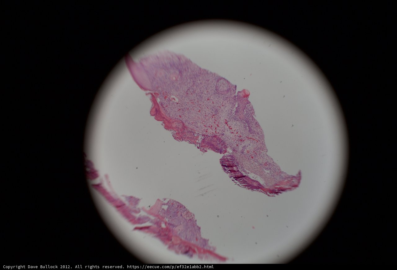 Purple-stained Sphere on a Microplate