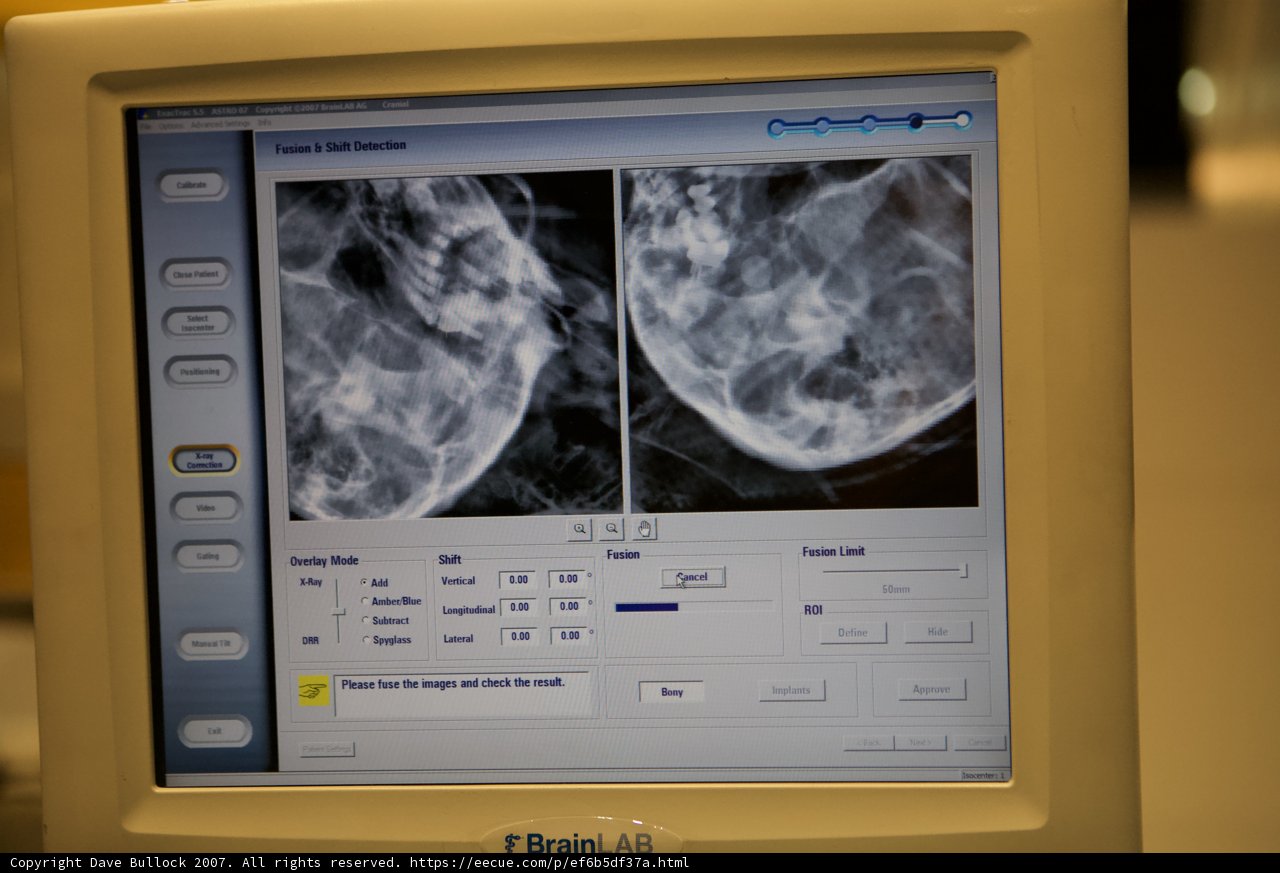 Medical Imaging on Computer Screen