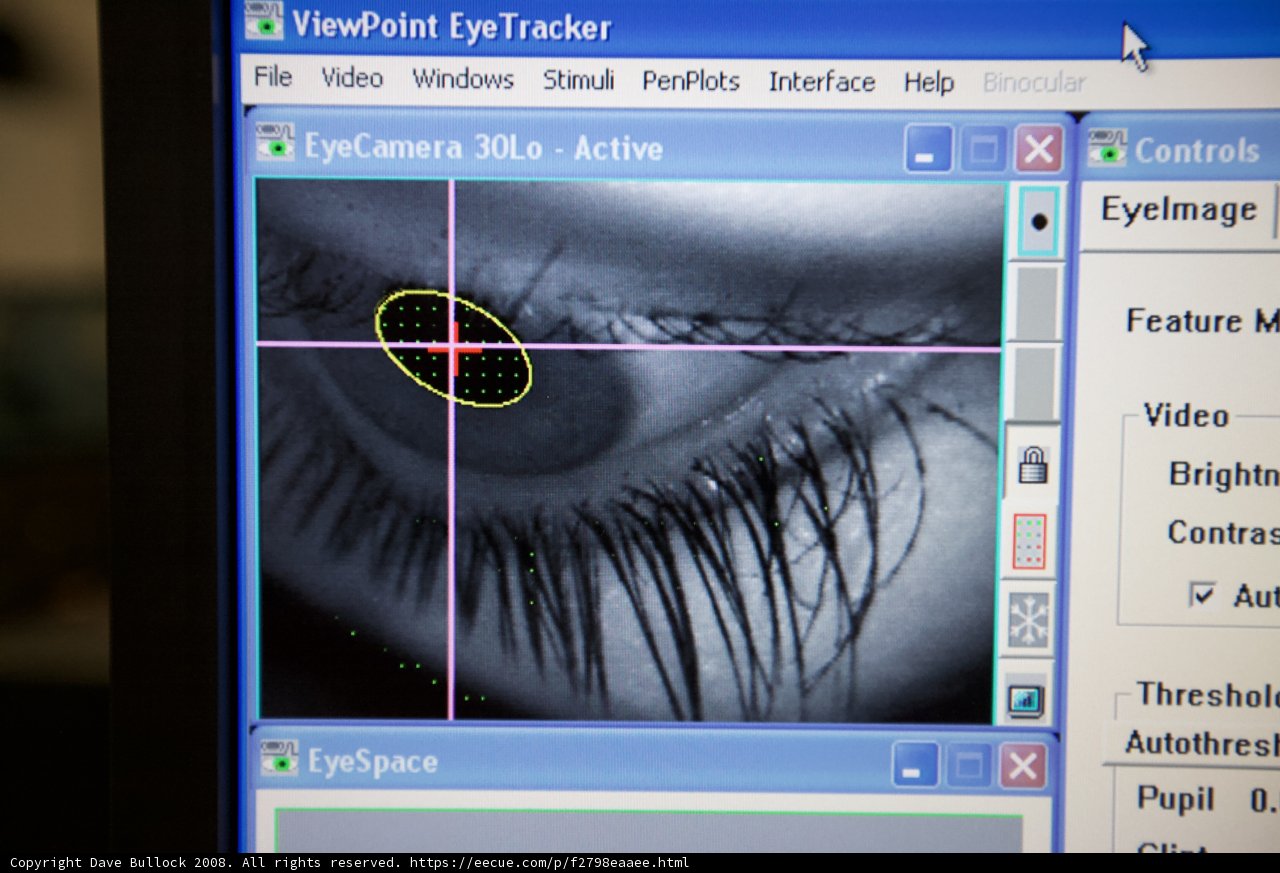 USC's Groundbreaking Eye Implants