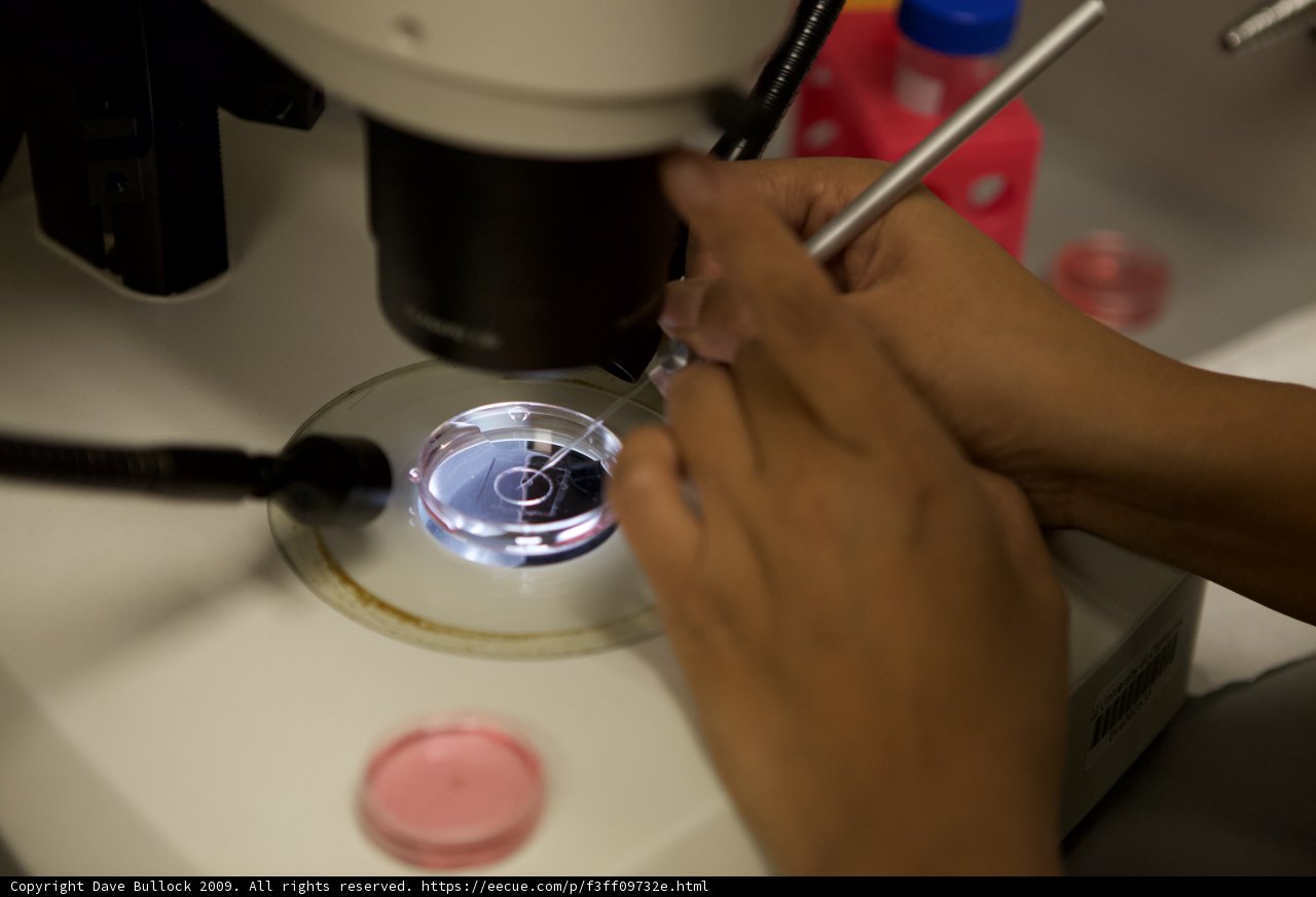 Microscopic View of a Person's Finger