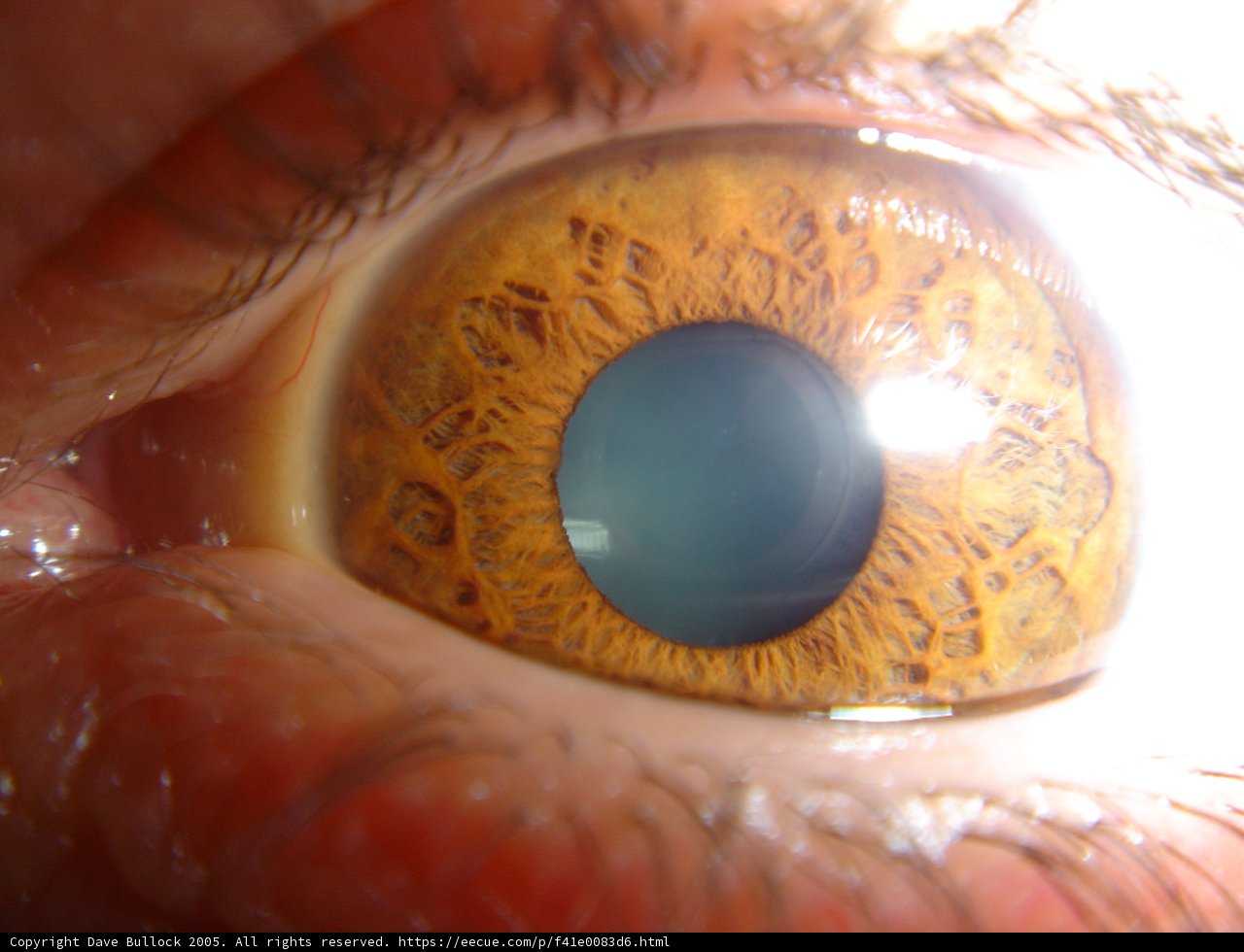 The Blue-eyed Wonder