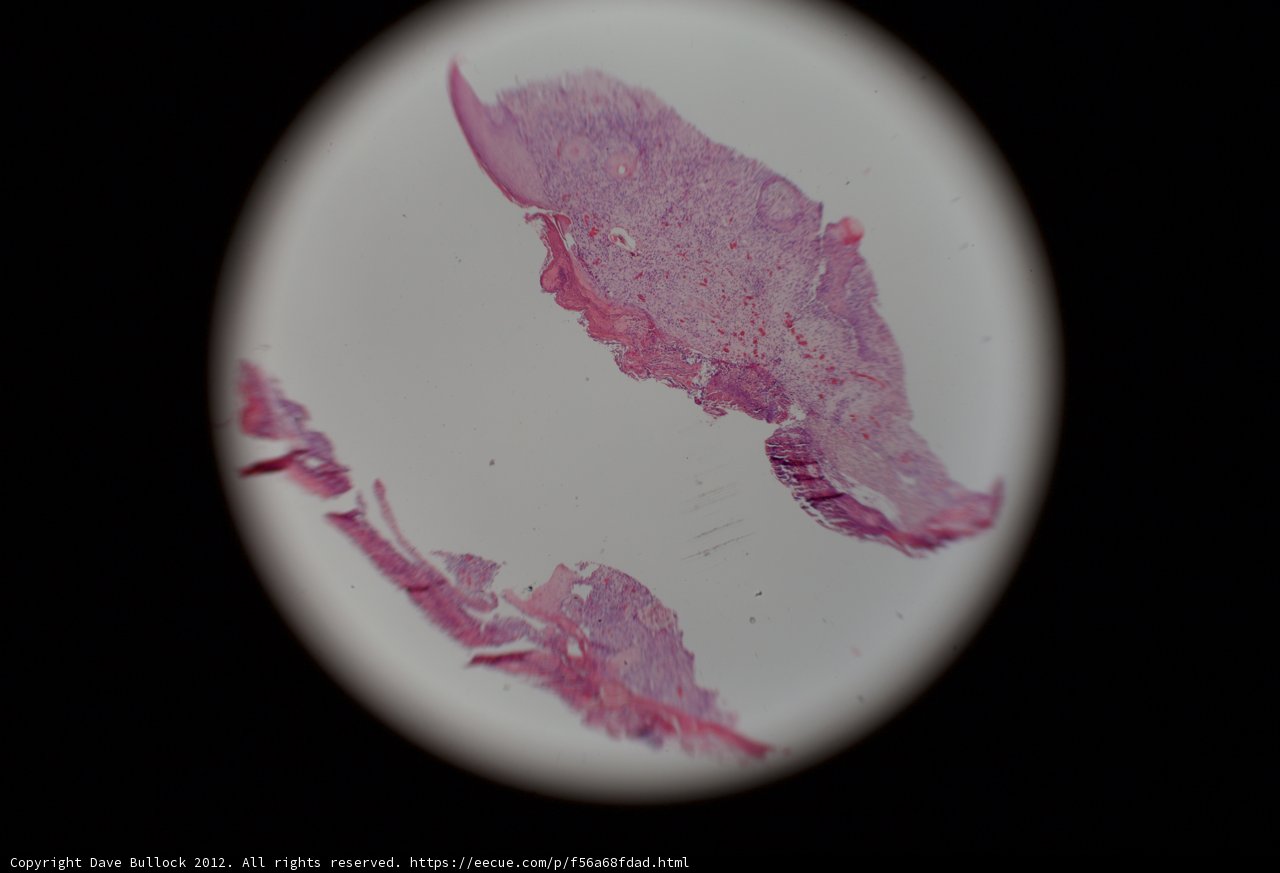 Stained Tissue under the Microscope