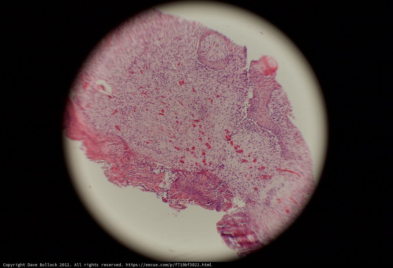 Stained Sphere in Tissue Plate