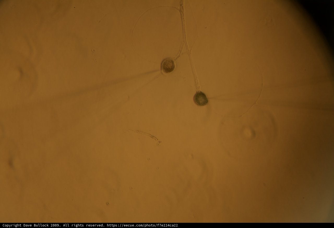 Nature's Tiny Sphere