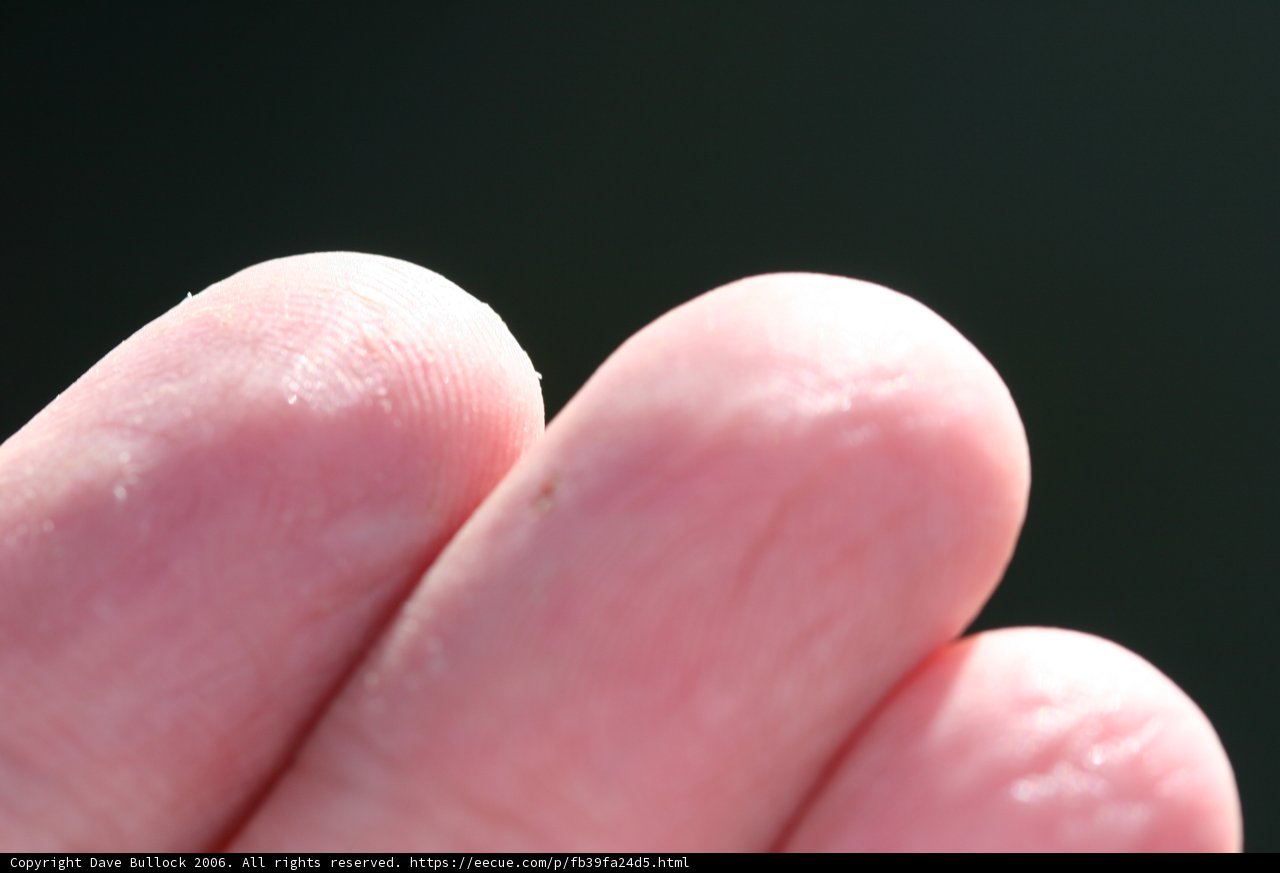 A Mysterious White Dot on the Finger