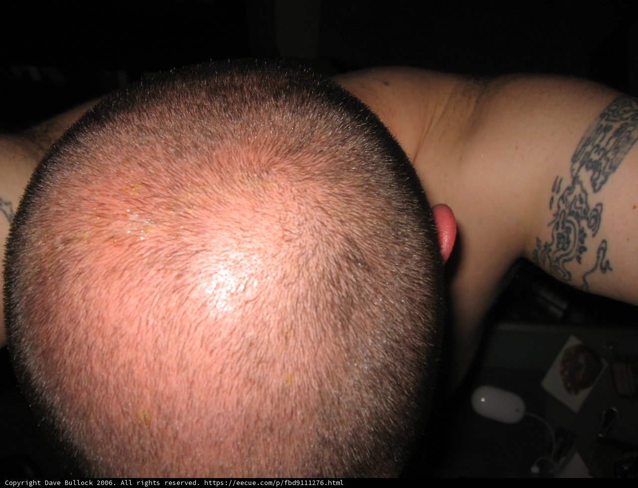 Skin Canvas