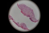 Vividly Stained Tissue