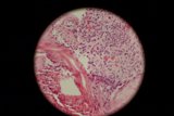 The Circular World of an Egg Tissue