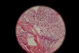 Egg Tissue Sample
