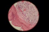 Pink and White Sphere Tissue