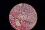 Egg Tissue Sphere