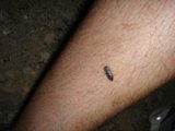 Unexpected Guest on Man's Leg