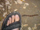 Unwanted Guest on My Foot