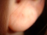 Red Spot on Ear