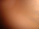 The Intensity of a Tiny Eye