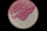 Pink Stain in Outer Space
