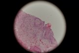 Tiny Tissue Sphere