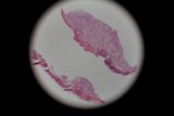 Stained Tissue Micrograph
