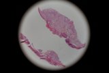 Stained Tissue Close Up
